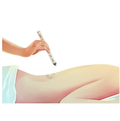 Prolongado tiempo de conservación Establo de moxibustión sin humo para la terapia de la medicina tradicional china